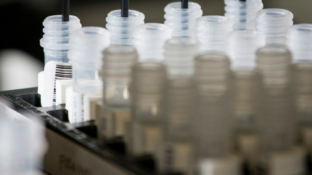 Genetik dizileme laboratuvarında mikroplaka ızgarası ve lazer tarama hattı